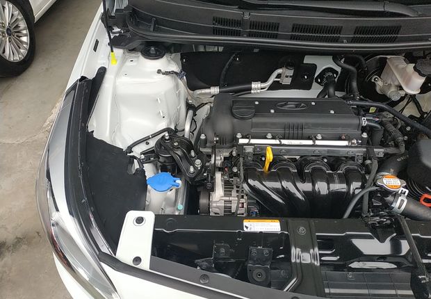 现代瑞纳 2016款 1.4L 自动 4门5座三厢车 智能型GLS (国Ⅴ) 